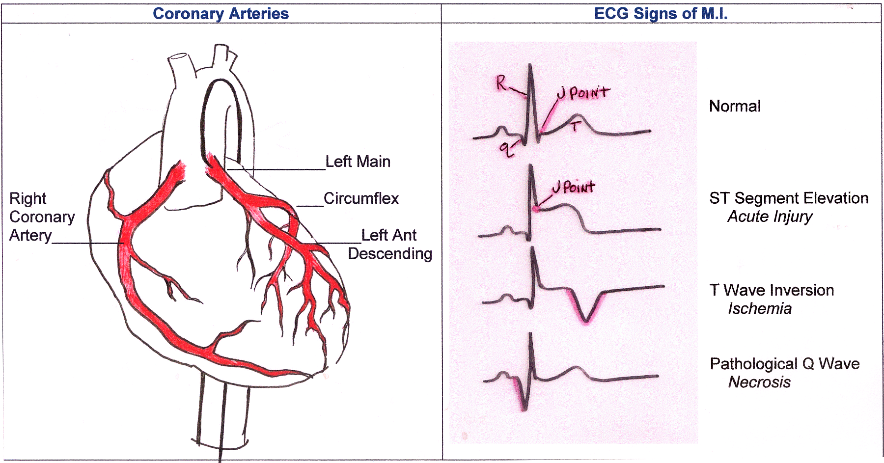 Illustration ecg guru instructor resources